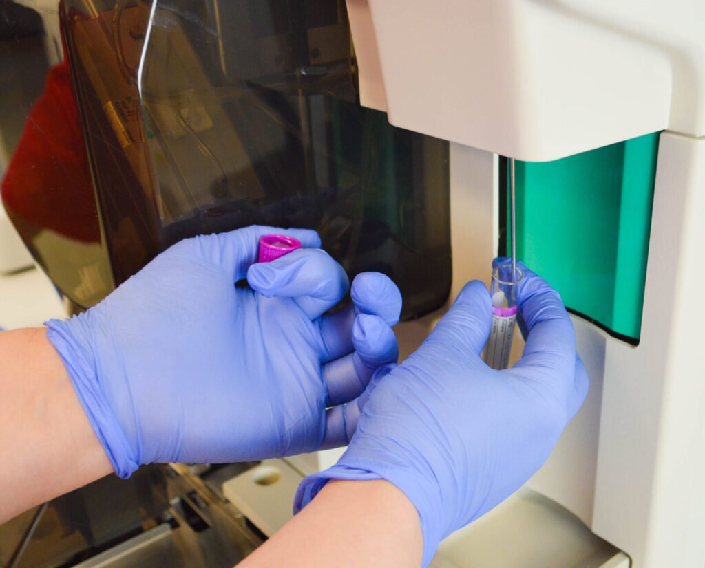 Lab technician loading a purple-top EDTA blood tube into a hematology analyzer