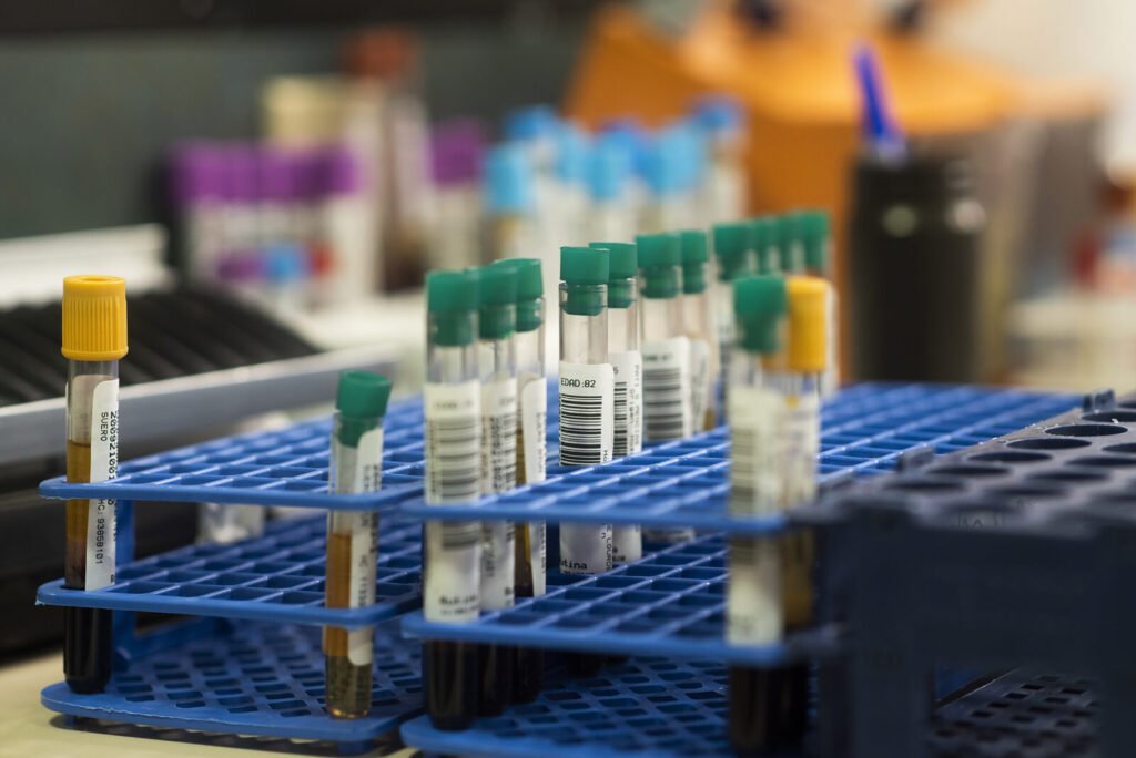 Test tubes in a tray in a laboratory