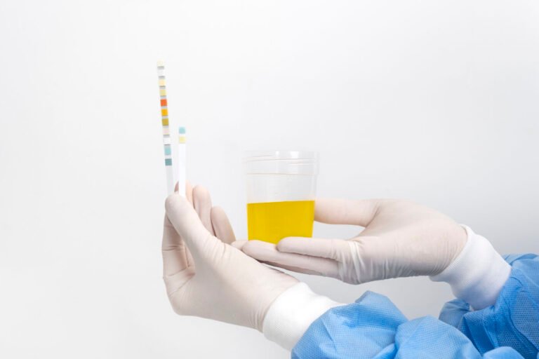 Gloved hands holding a urine test strip beside a sample cup