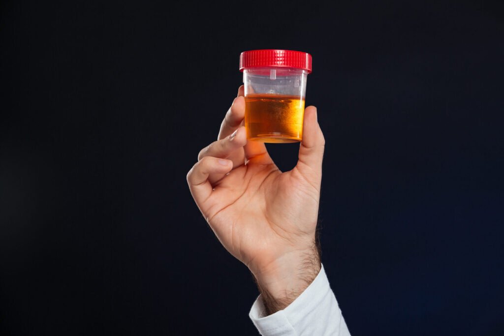 Urine sample container for urinalysis