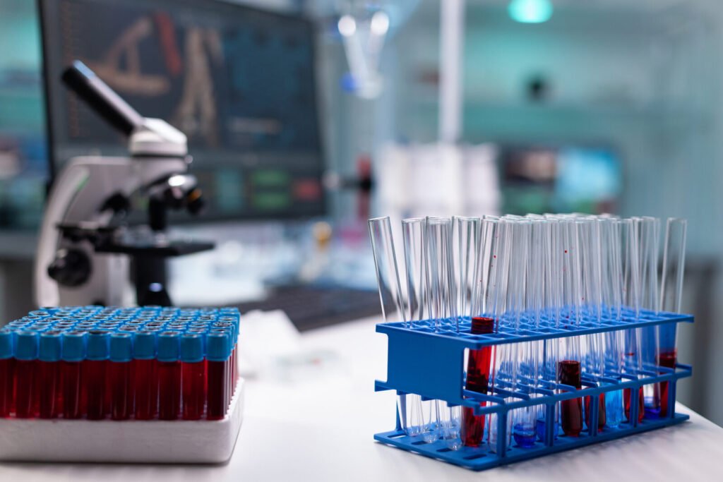 Sample tubes and lab supplies on a tray in a laboratory
