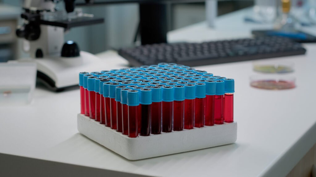 Tray of sample tubes on a laboratory desk