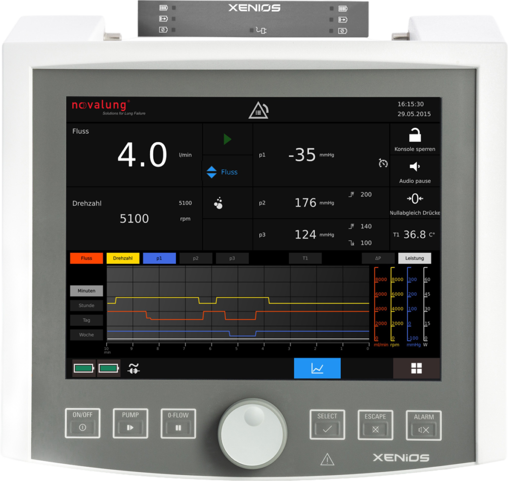 Xenios console ECMO system by Fresenius Medical Care